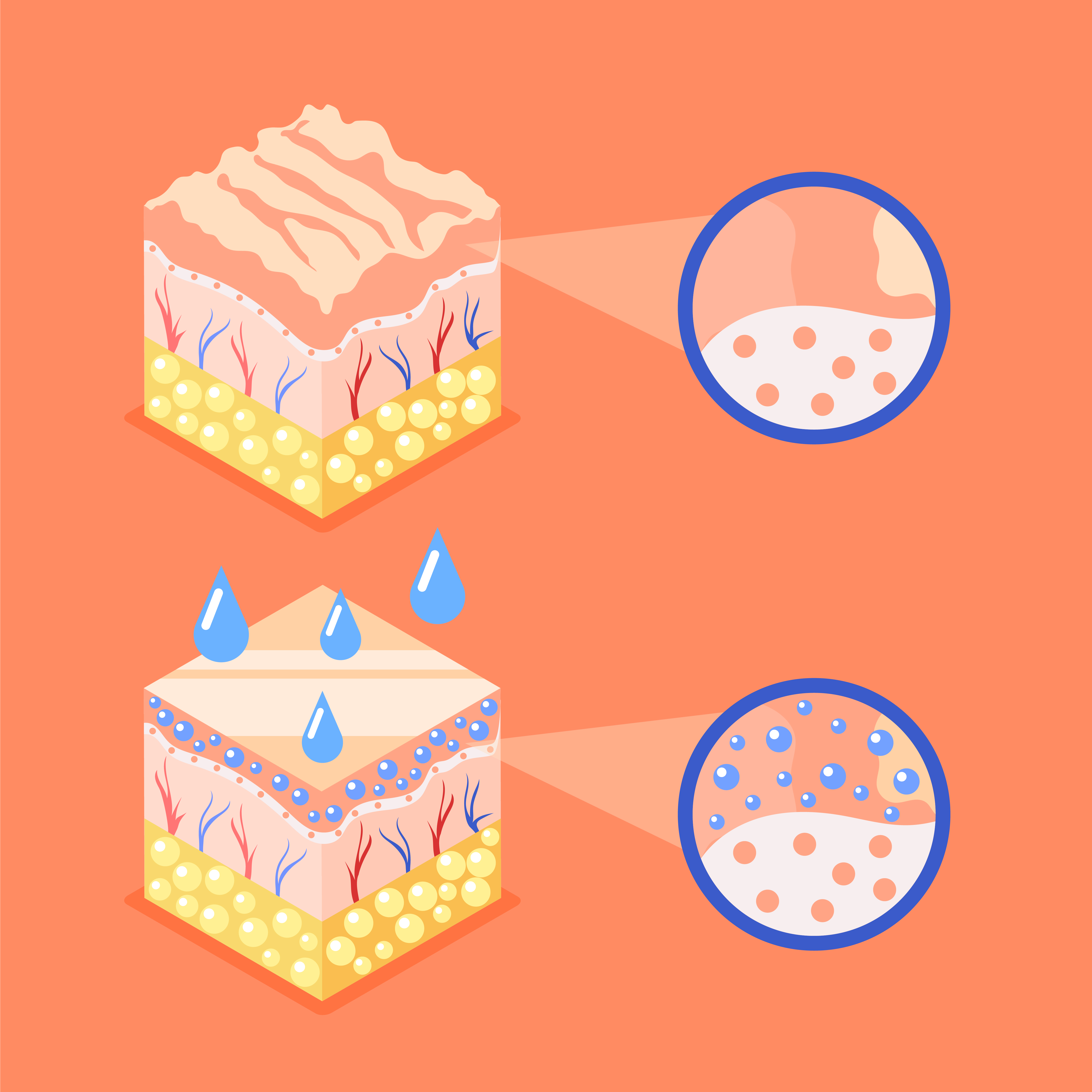 2 animated cut outs of dry and hydrated skin
